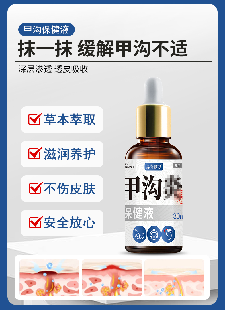 抹一抹，緩解甲溝不適